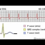 Advanced Cardiac Diagnostic Tests in Dubai