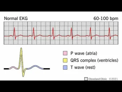 Advanced Cardiac Diagnostic Tests in Dubai